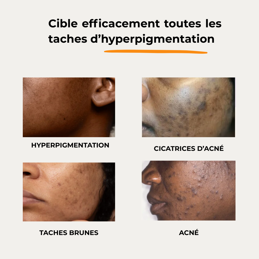 Cotons Anti-imperfections