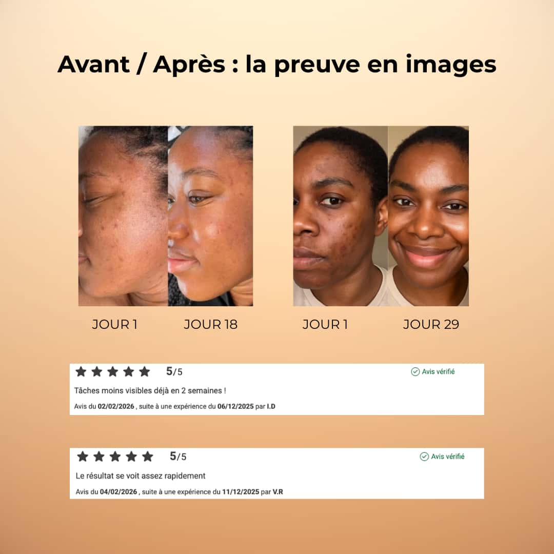 Cotons au Curcuma Anti-Taches