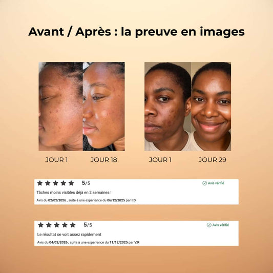 COTONS ANTI-TACHES