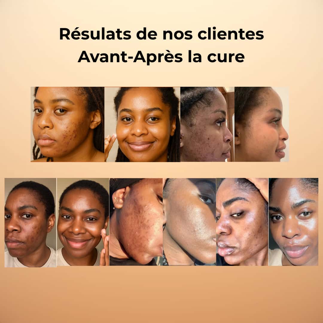CRÈME HYDRATANTE