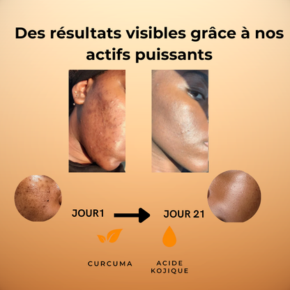 COTONS ANTI-TACHES